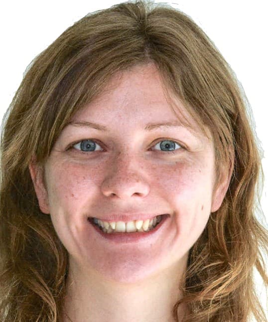Caso Clínico 2: Corrección de Estética Avanzada, Mordida Cubierta y Apiñamiento Dental - cara - antes
